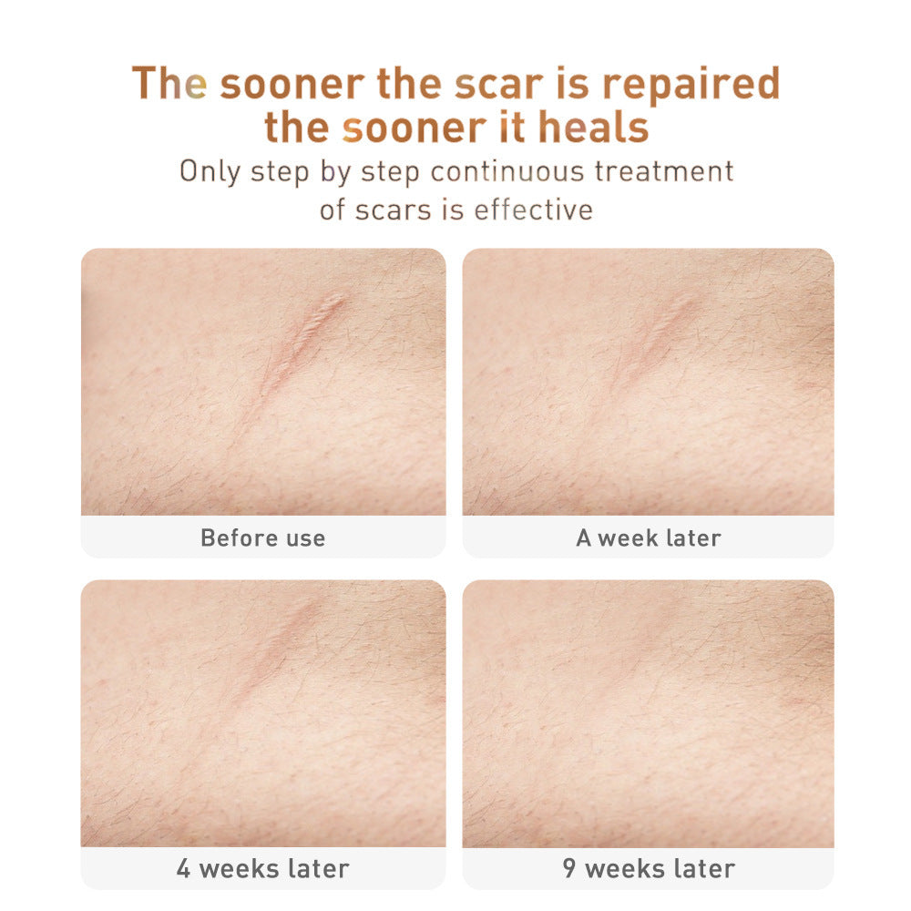 Traditional Chinese Medicine Scar Removal Cream Care Cream Skin Care Products - Kennedy Conglomerate Inc 