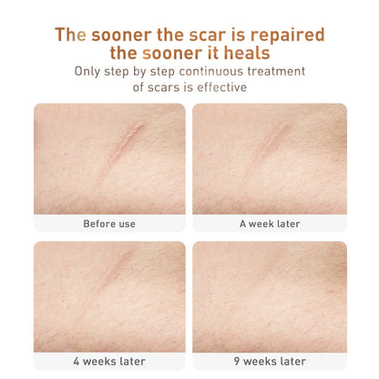 Traditional Chinese Medicine Scar Removal Cream Care Cream Skin Care Products - Kennedy Conglomerate Inc 